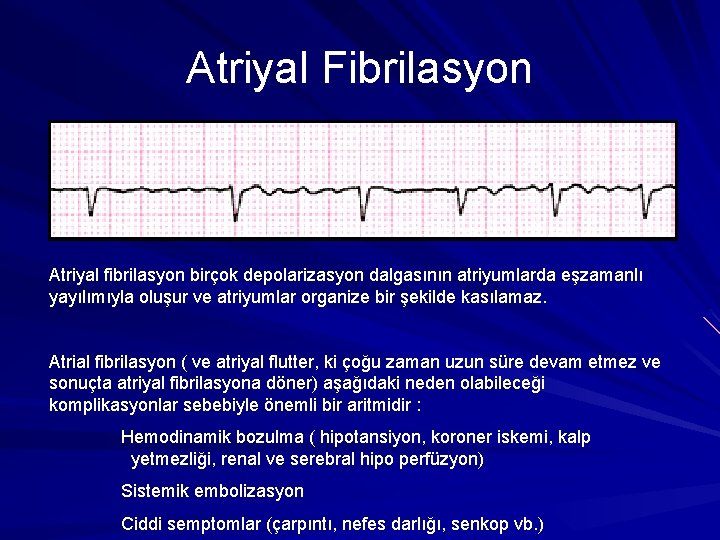 Atriyal Fibrilasyon Atriyal fibrilasyon birçok depolarizasyon dalgasının atriyumlarda eşzamanlı yayılımıyla oluşur ve atriyumlar organize Atriyal Fibrilasyon Atriyal fibrilasyon birçok depolarizasyon dalgasının atriyumlarda eşzamanlı yayılımıyla oluşur ve atriyumlar organize