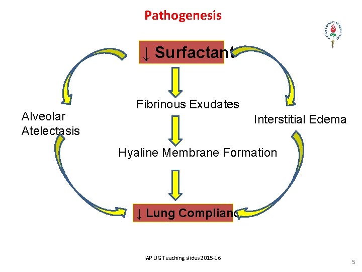 Pathogenesis ↓ Surfactant Alveolar Atelectasis Fibrinous Exudates Interstitial Edema Hyaline Membrane Formation ↓ Lung