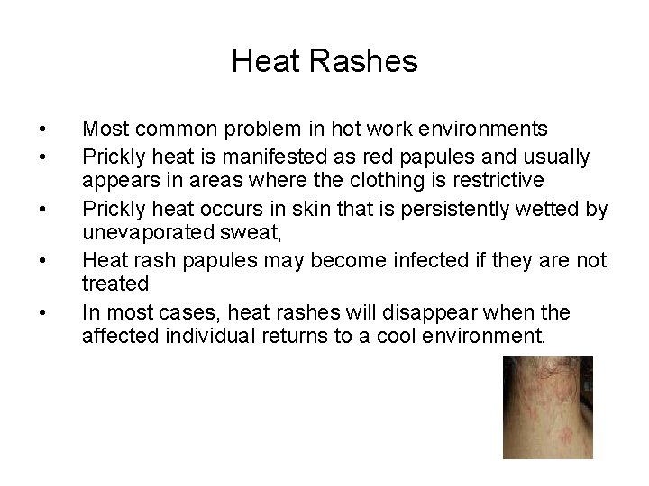 Heat Rashes • • • Most common problem in hot work environments Prickly heat