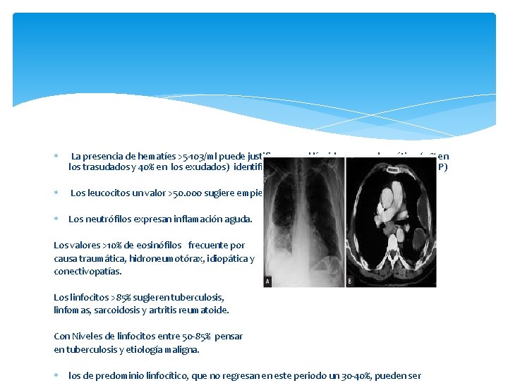  La presencia de hematíes >5 -103/ml puede justificar que el líquido sea serohemático