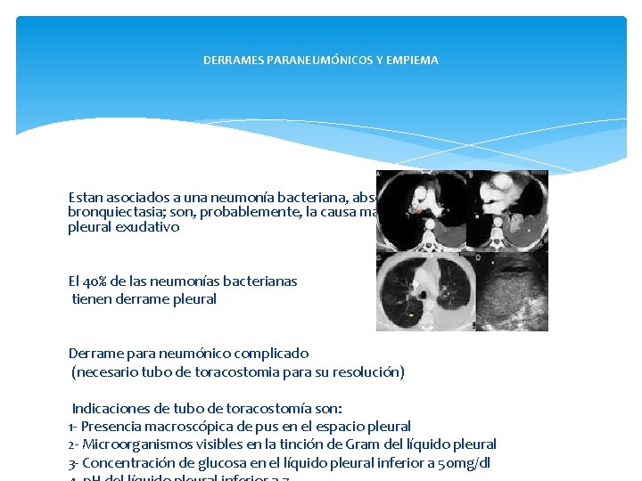 DERRAMES PARANEUMÓNICOS Y EMPIEMA Estan asociados a una neumonía bacteriana, absceso pulmonar o bronquiectasia;