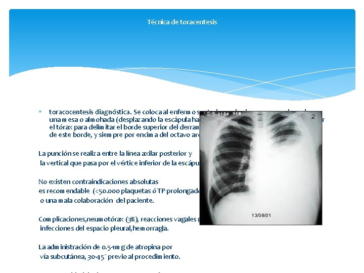 Técnica de toracentesis toracocentesis diagnóstica. Se coloca al enfermo sentado con los brazos apoyados