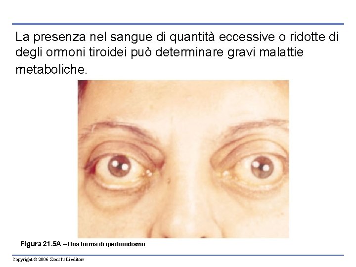 La presenza nel sangue di quantità eccessive o ridotte di degli ormoni tiroidei può La presenza nel sangue di quantità eccessive o ridotte di degli ormoni tiroidei può