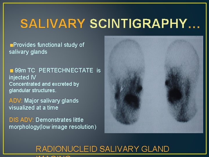 SALIVARY SCINTIGRAPHY… Provides functional study of salivary glands 99 m TC PERTECHNECTATE is injected