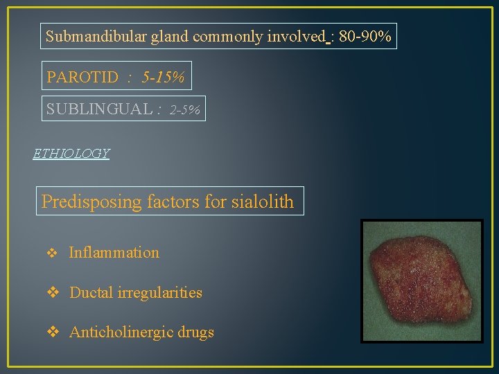 Submandibular gland commonly involved : 80 -90% PAROTID : 5 -15% SUBLINGUAL : 2