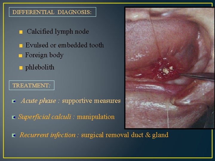 DIFFERENTIAL DIAGNOSIS: Calcified lymph node Evulsed or embedded tooth Foreign body phlebolith TREATMENT: Acute