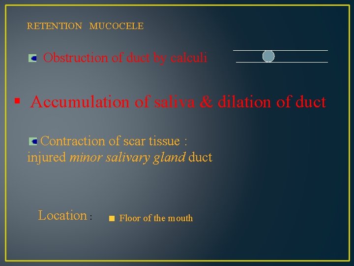 RETENTION MUCOCELE Obstruction of duct by calculi § Accumulation of saliva & dilation of