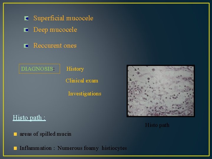 Superficial mucocele Deep mucocele Reccurent ones DIAGNOSIS: History Clinical exam Investigations Histo path :