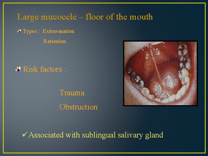 Large mucocele – floor of the mouth Types : Extravasation Retention Risk factors :