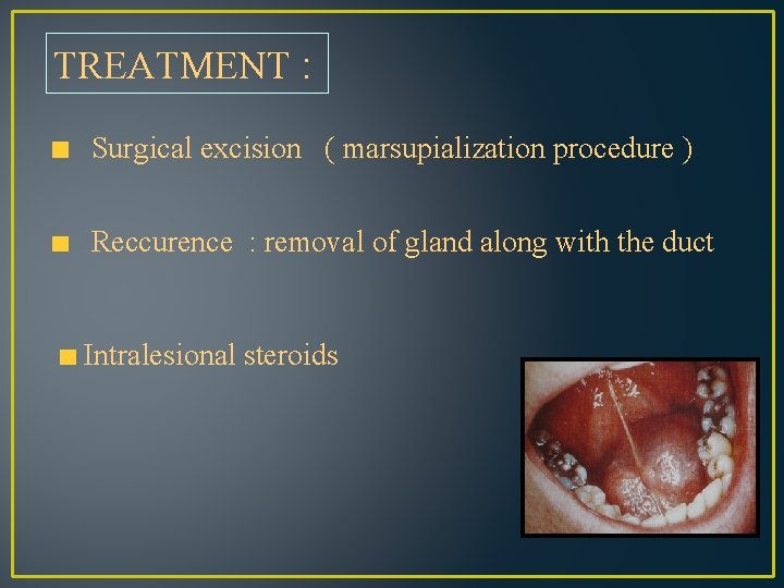 TREATMENT : Surgical excision ( marsupialization procedure ) Reccurence : removal of gland along