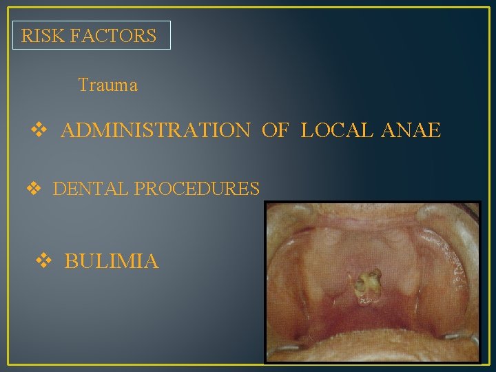 RISK FACTORS Trauma v ADMINISTRATION OF LOCAL ANAE v DENTAL PROCEDURES v BULIMIA 