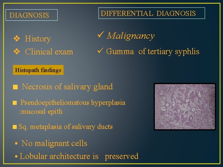 DIAGNOSIS v History v Clinical exam DIFFERENTIAL DIAGNOSIS ü Malignancy ü Gumma of tertiary