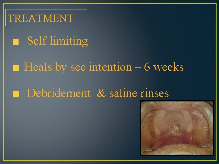 TREATMENT Self limiting Heals by sec intention – 6 weeks Debridement & saline rinses