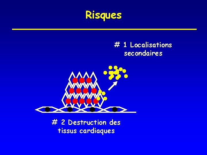 Risques # 1 Localisations secondaires # 2 Destruction des tissus cardiaques 