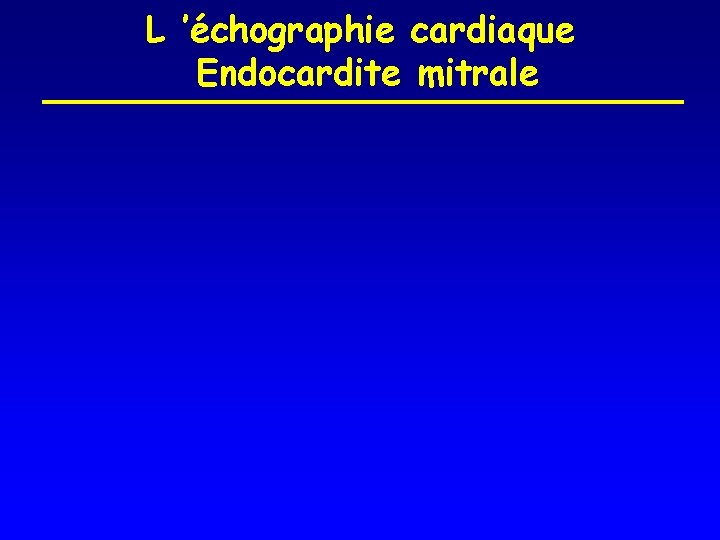 L ’échographie cardiaque Endocardite mitrale 