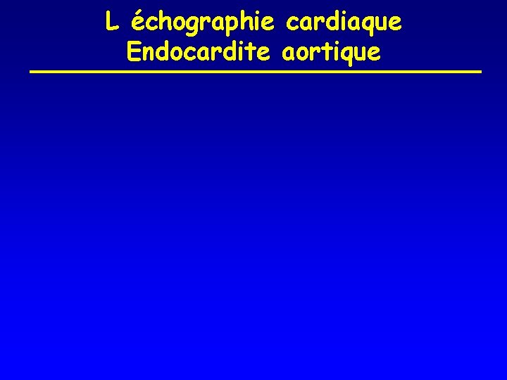 L échographie cardiaque Endocardite aortique 