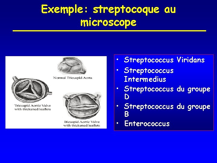 Exemple: streptocoque au microscope • Streptococcus Viridans • Streptococcus Intermedius • Streptococcus du groupe