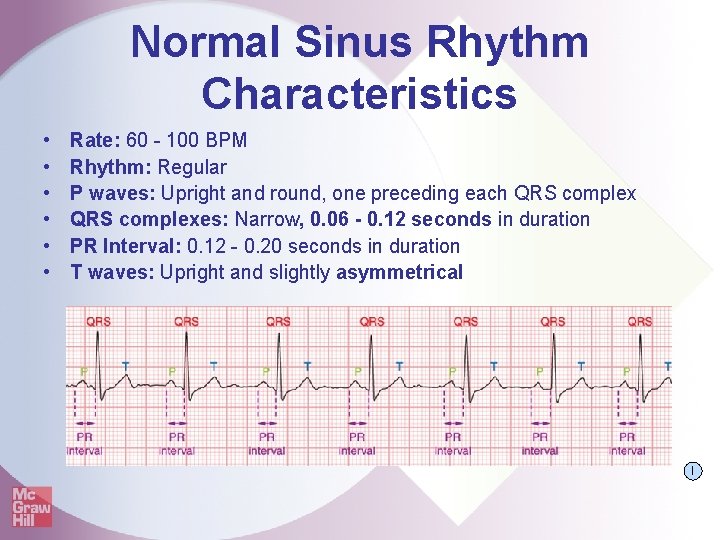 Normal Sinus Rhythm Characteristics • • • Rate: 60 - 100 BPM Rhythm: Regular