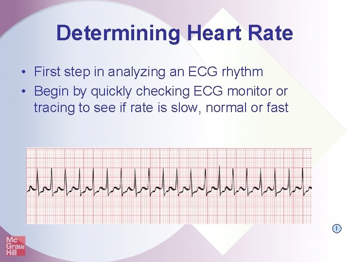 Determining Heart Rate • First step in analyzing an ECG rhythm • Begin by