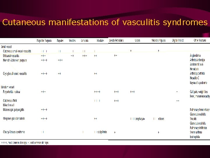 Cutaneous manifestations of vasculitis syndromes 