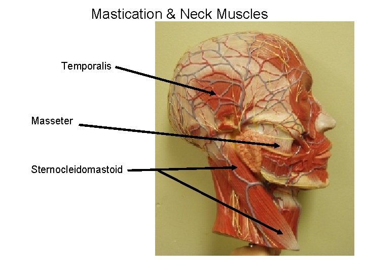 Mastication & Neck Muscles Temporalis Masseter Sternocleidomastoid 