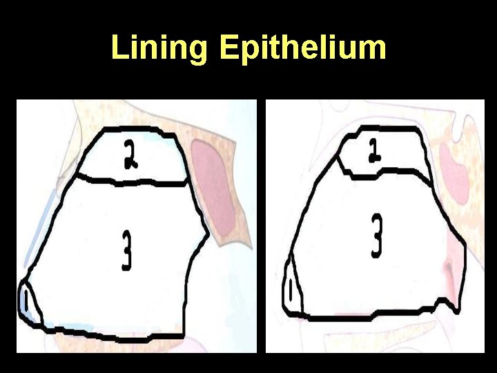 Lining Epithelium 