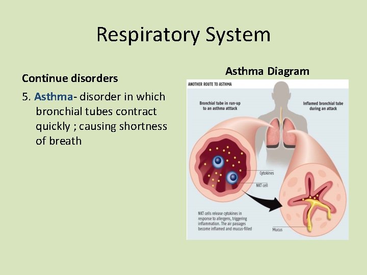 Respiratory System Continue disorders 5. Asthma- disorder in which bronchial tubes contract quickly ;