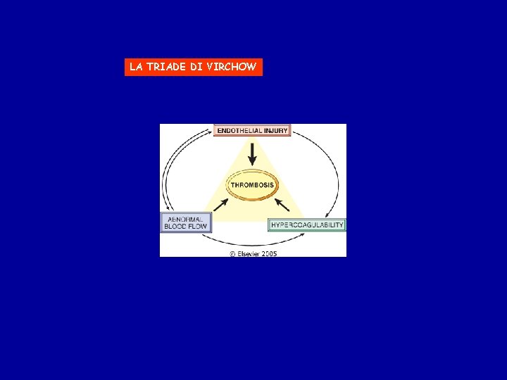 LA TRIADE DI VIRCHOW 