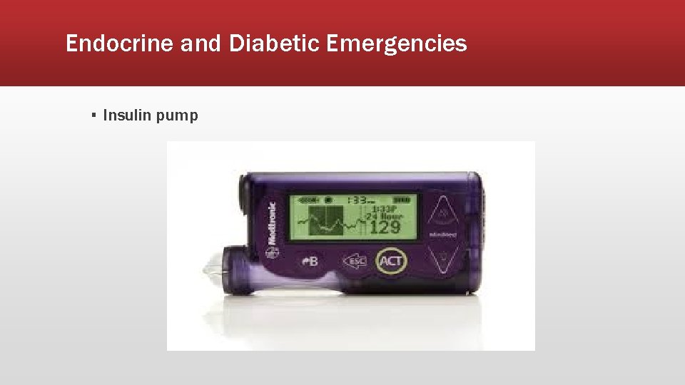 Endocrine and Diabetic Emergencies ▪ Insulin pump 