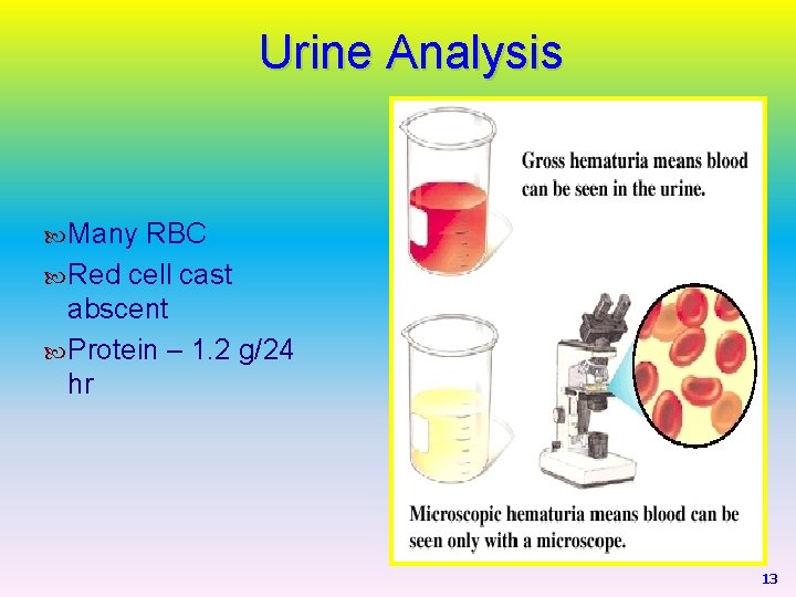 Urine Analysis Many RBC Red cell cast abscent Protein – 1. 2 g/24 hr