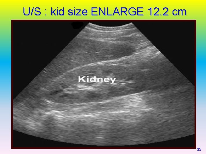 U/S : kid size ENLARGE 12. 2 cm 15 