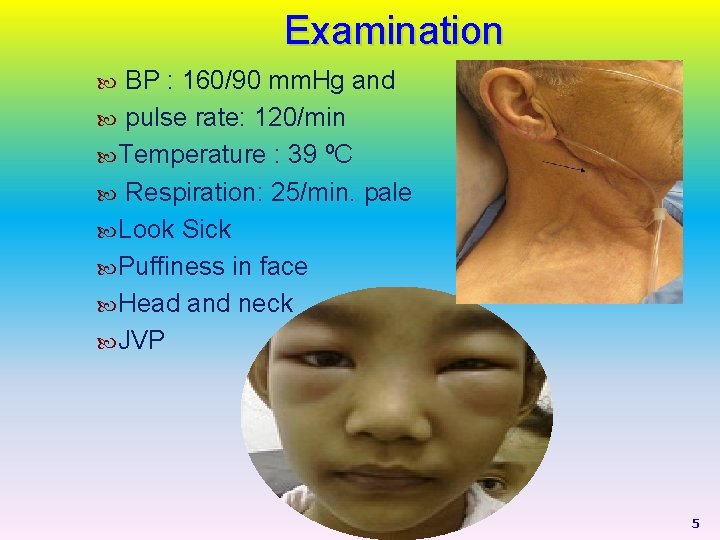 Examination BP : 160/90 mm. Hg and pulse rate: 120/min Temperature : 39 ºC