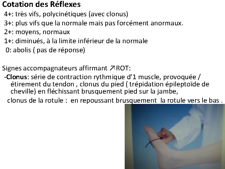 Cotation des Réflexes 4+: très vifs, polycinétiques (avec clonus) 3+: plus vifs que la