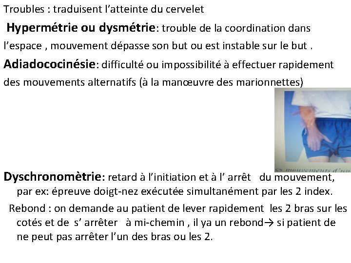 Troubles : traduisent l’atteinte du cervelet Hypermétrie ou dysmétrie: trouble de la coordination dans