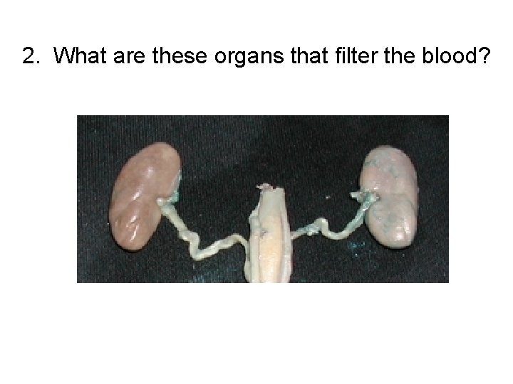 2. What are these organs that filter the blood? 