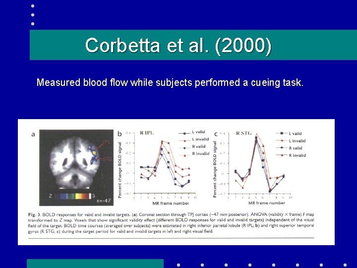 Corbetta et al. (2000) Measured blood flow while subjects performed a cueing task. 