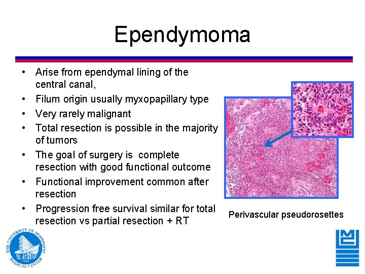 Ependymoma • Arise from ependymal lining of the central canal, • Filum origin usually Ependymoma • Arise from ependymal lining of the central canal, • Filum origin usually