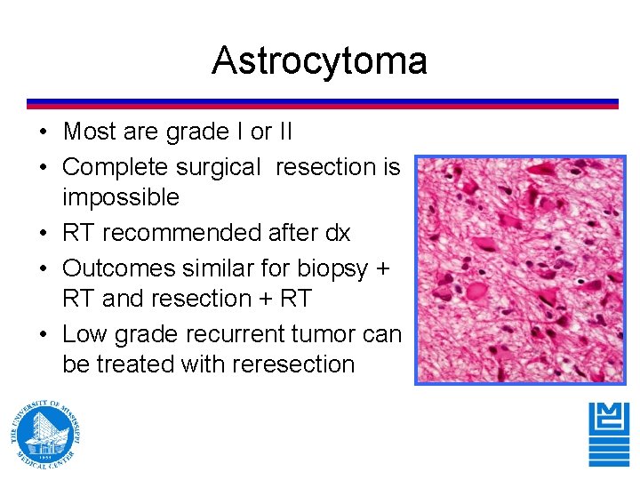 Astrocytoma • Most are grade I or II • Complete surgical resection is impossible Astrocytoma • Most are grade I or II • Complete surgical resection is impossible