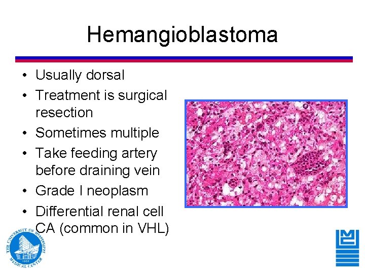 Hemangioblastoma • Usually dorsal • Treatment is surgical resection • Sometimes multiple • Take Hemangioblastoma • Usually dorsal • Treatment is surgical resection • Sometimes multiple • Take