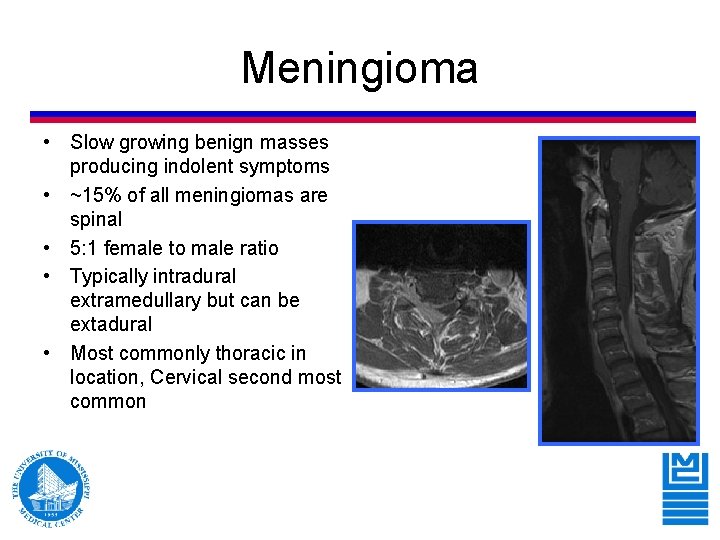 Meningioma • Slow growing benign masses producing indolent symptoms • ~15% of all meningiomas Meningioma • Slow growing benign masses producing indolent symptoms • ~15% of all meningiomas