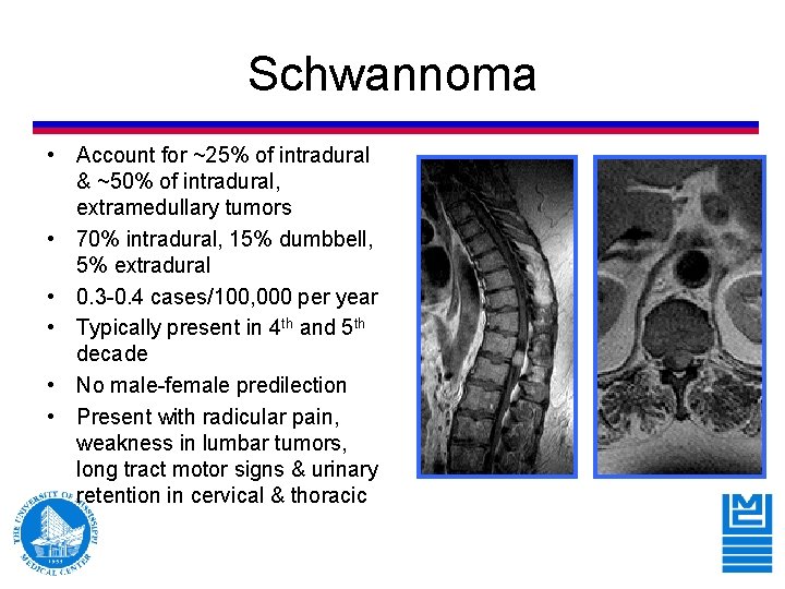 Schwannoma • Account for ~25% of intradural & ~50% of intradural, extramedullary tumors • Schwannoma • Account for ~25% of intradural & ~50% of intradural, extramedullary tumors •