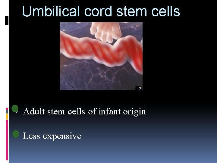 Umbilical cord stem cells • Adult stem cells of infant origin • Less expensive Umbilical cord stem cells • Adult stem cells of infant origin • Less expensive