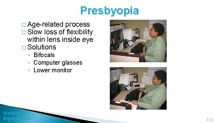 Presbyopia � Age-related process � Slow loss of flexibility within lens inside eye �