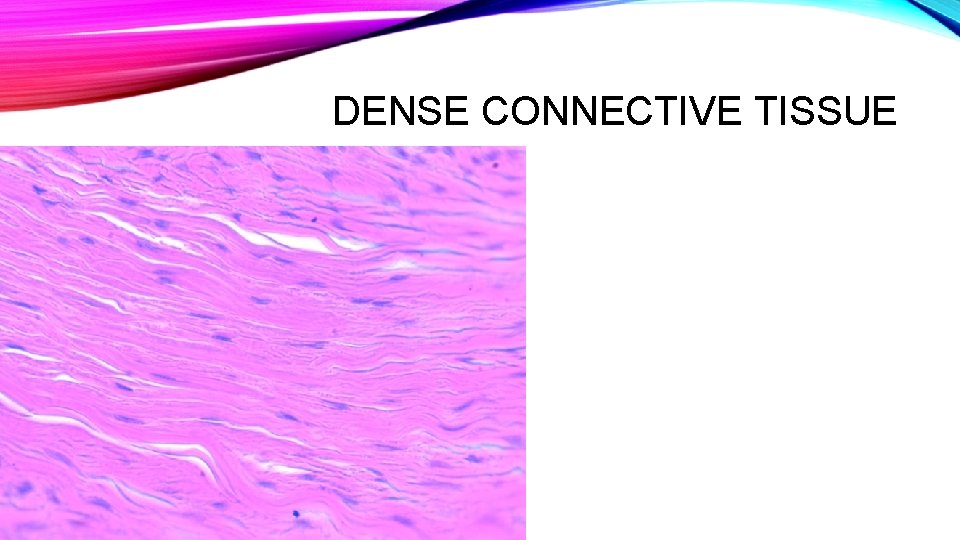 DENSE CONNECTIVE TISSUE 
