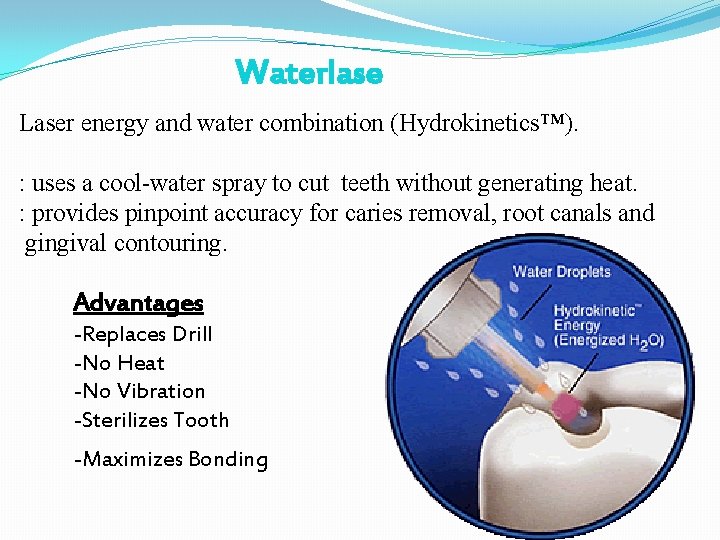 Waterlase Laser energy and water combination (Hydrokinetics™). : uses a cool-water spray to cut Waterlase Laser energy and water combination (Hydrokinetics™). : uses a cool-water spray to cut