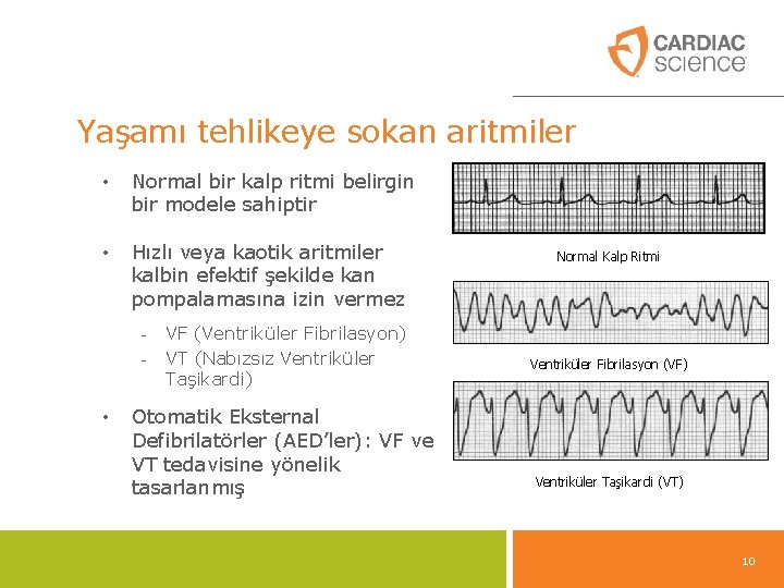 Yaşamı tehlikeye sokan aritmiler • Normal bir kalp ritmi belirgin bir modele sahiptir • Yaşamı tehlikeye sokan aritmiler • Normal bir kalp ritmi belirgin bir modele sahiptir •
