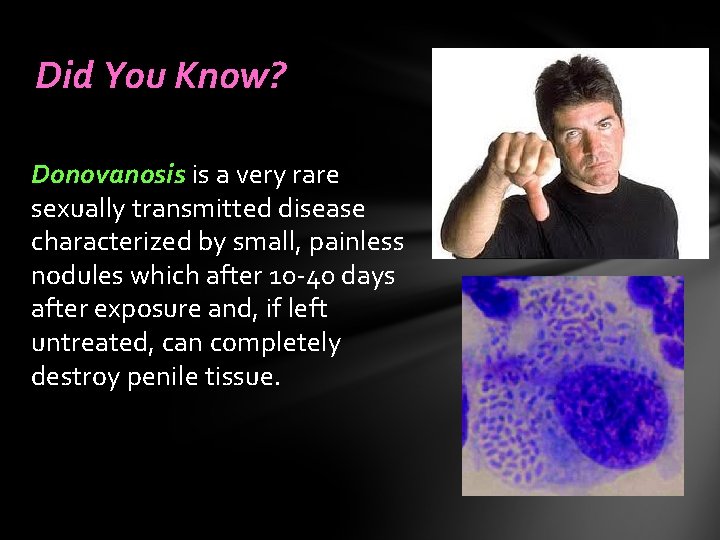 Did You Know? Donovanosis is a very rare sexually transmitted disease characterized by small,