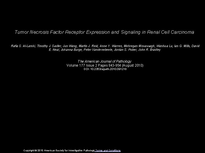 Tumor Necrosis Factor Receptor Expression and Signaling in Renal Cell Carcinoma Rafia S. Al-Lamki,