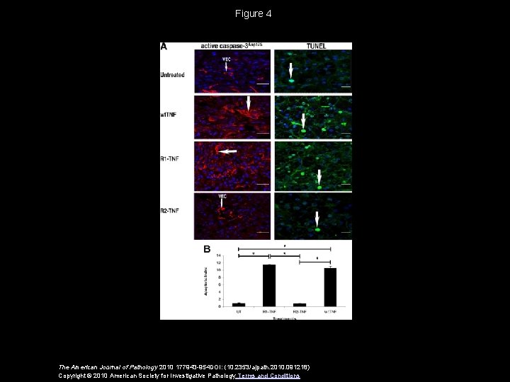 Figure 4 The American Journal of Pathology 2010 177943 -954 DOI: (10. 2353/ajpath. 2010.