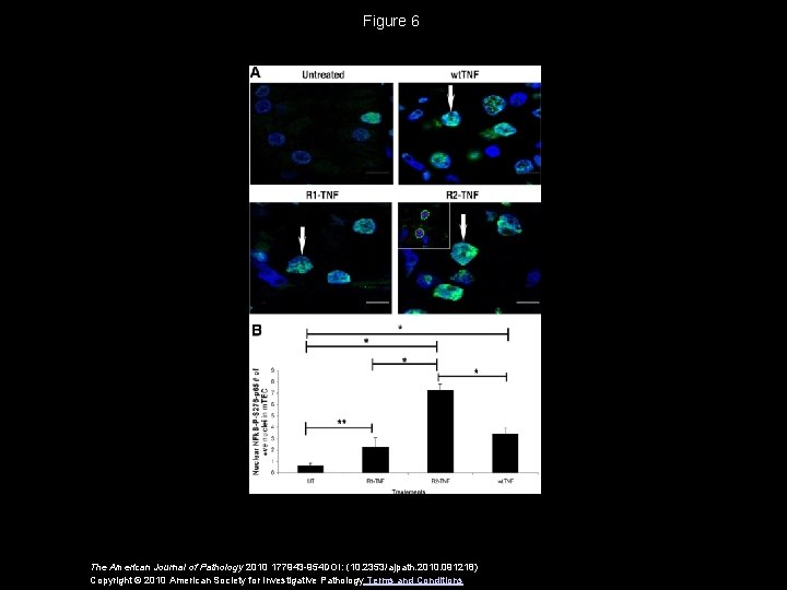 Figure 6 The American Journal of Pathology 2010 177943 -954 DOI: (10. 2353/ajpath. 2010.